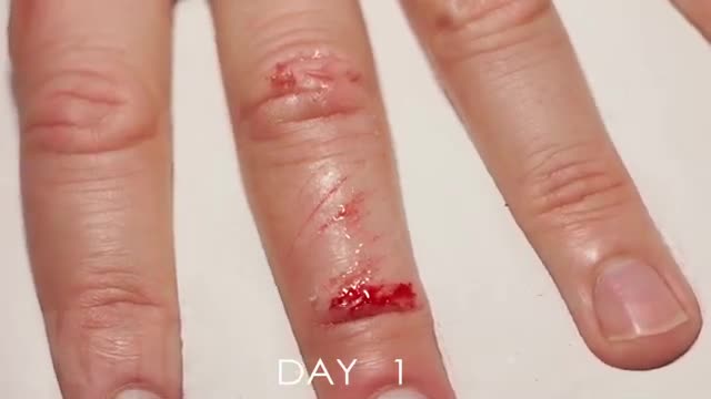 La cicatrisation en 33 jours (timelapse)